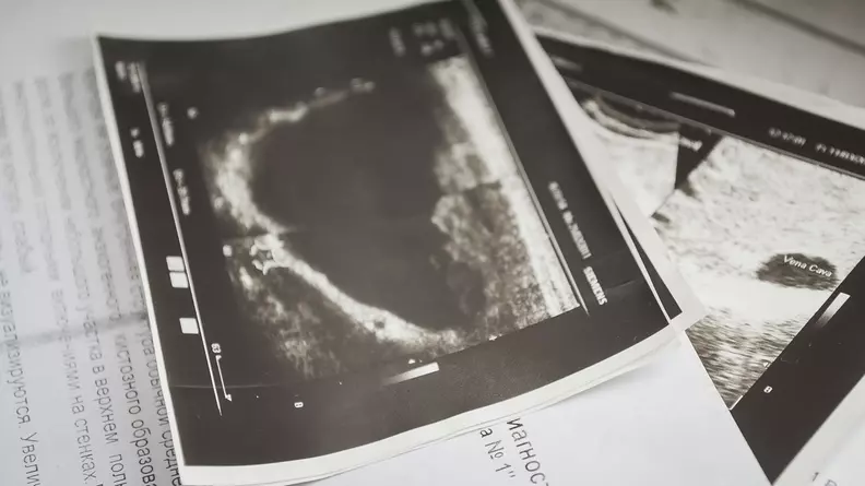 Новый цифровой рентген-аппарат появился в Каскаринской больнице