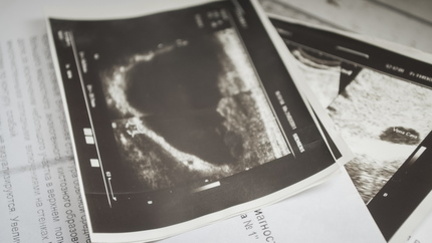 Новое оборудование позволило уватским врачам увеличить число рентген-исследований