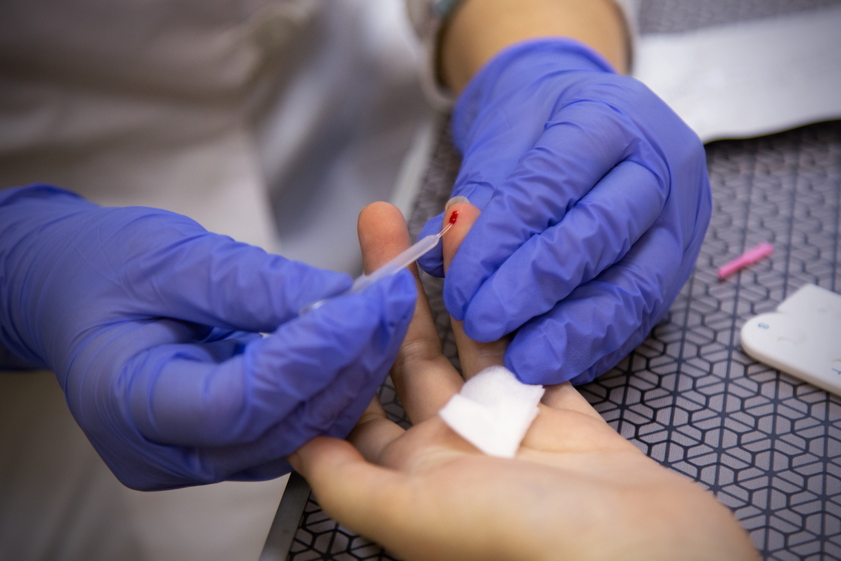 В Тюмени открывается новый пункт тестирования на ВИЧ