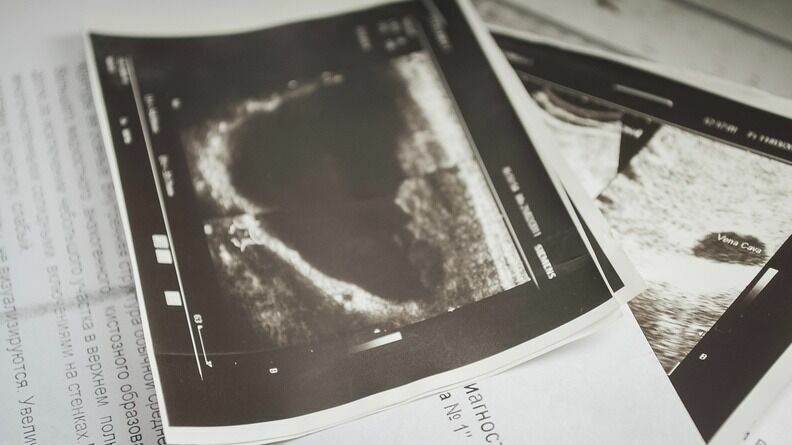 Новый современный рентген появился в отделении лучевой диагностики Тюменской ОКБ