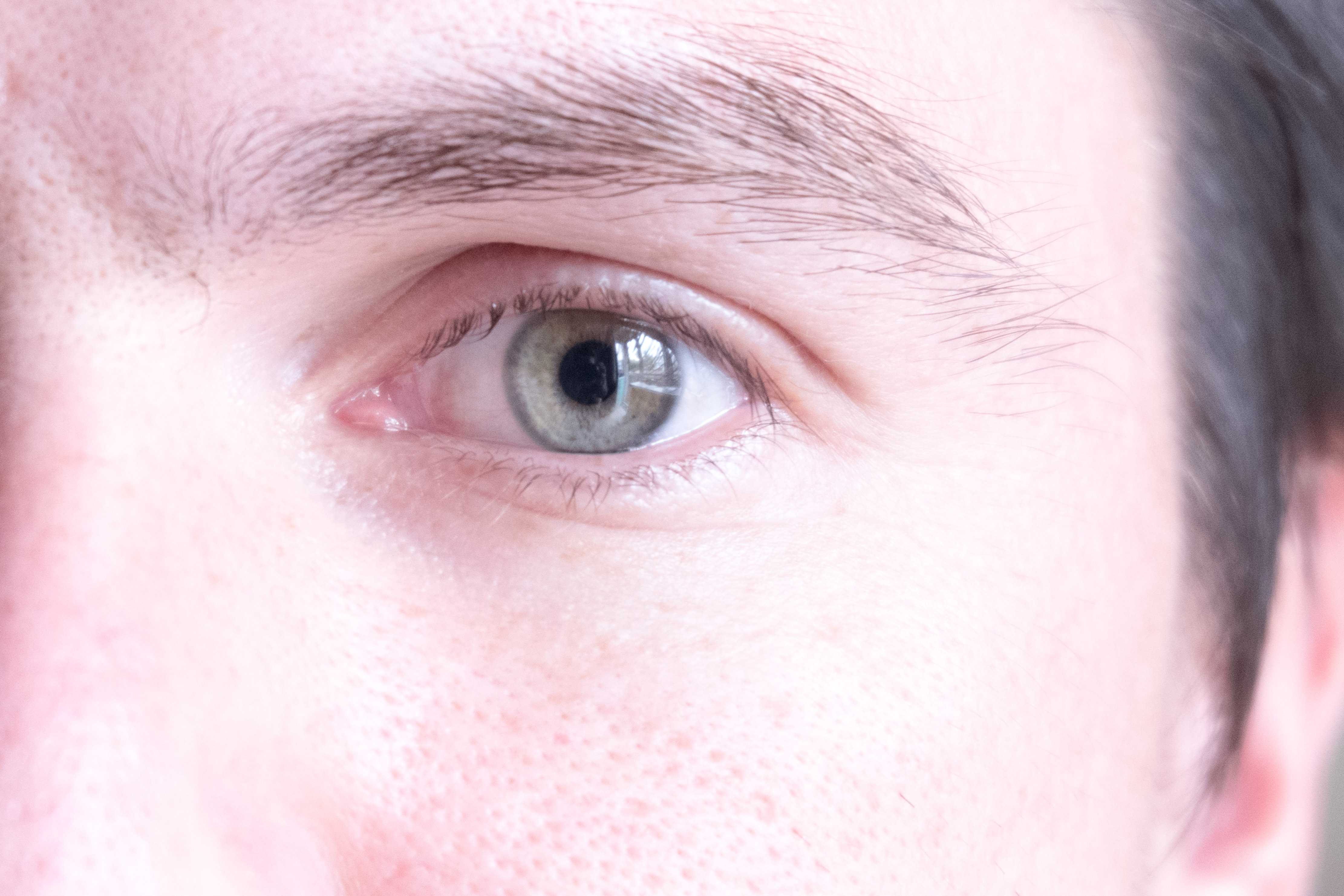 В Тобольске офтальмологи владеют новейшим методом лечения катаракты